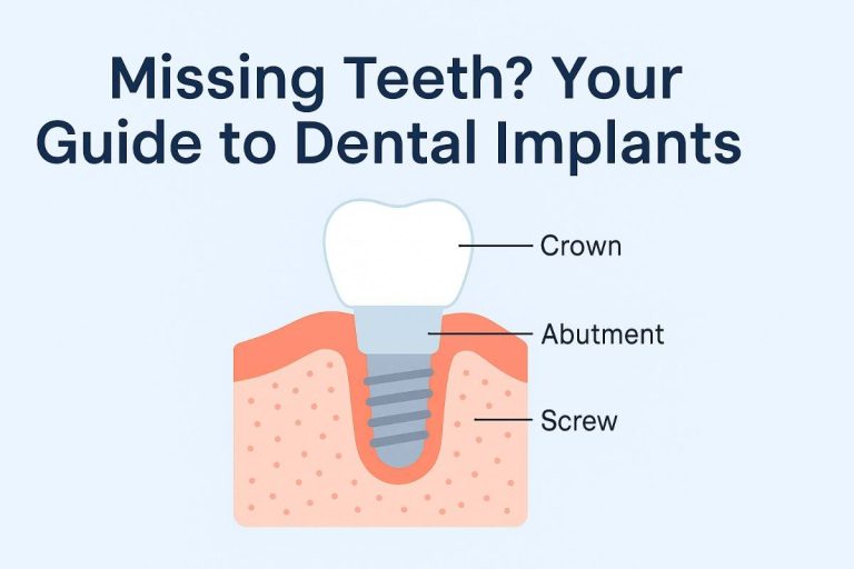 Missing Teeth? Your Guide to Dental Implants